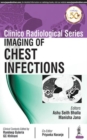 Image for Imaging of chest infections