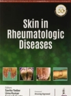 Image for Skin in Rheumatologic Diseases