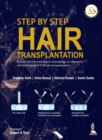 Image for Step by Step Hair Transplantation