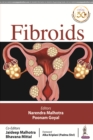 Image for FIBROIDS