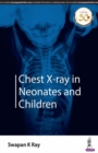 Image for Chest X-ray in Neonates and Children