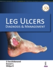 Image for Leg Ulcers : Diagnosis &amp; Management