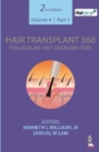Image for Hair Transplant 360: Follicular Unit Excision (FUE)