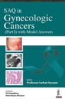 Image for SAQ in Gynecologic Cancers