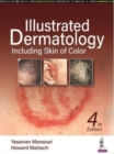 Image for Illustrated Dermatology