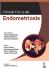 Image for Clinical Focus on Endometriosis
