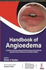 Image for Handbook of Angioedema