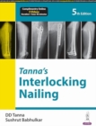 Image for Tanna’s Interlocking Nailing