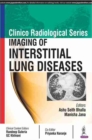 Image for Clinico Radiological Series: Imaging of Interstitial Lung Diseases
