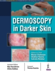 Image for Dermoscopy in Darker Skin