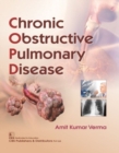 Image for Chronic Obstructive Pulmonary Disease
