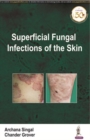 Image for Superficial Fungal Infections of the Skin
