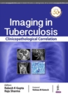 Image for Imaging in Tuberculosis