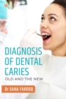 Image for Diagnosis of Dental Caries-Old and the New