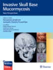 Image for Invasive Skull Base Mucormycosis