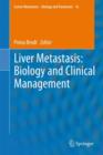 Image for Liver Metastasis: Biology and Clinical Management