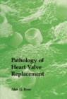 Image for Pathology of Heart Valve Replacement