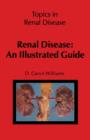 Image for Renal disease: an illustrated guide