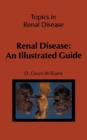 Image for Renal Disease: An Illustrated Guide