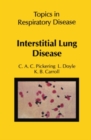 Image for Interstitial lung disease