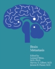 Image for Brain Metastasis : v.2