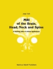 Image for MRI of the Brain, Head, Neck and Spine