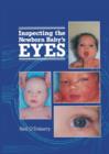 Image for Inspecting the Newborn Baby&#39;s Eyes