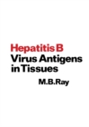Image for Hepatitis B Virus Antigens in Tissues