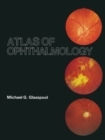 Image for Atlas of ophthalmology
