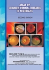 Image for The Atlas of Retinal Diseases in Nigerians