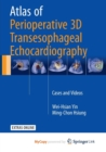 Image for Atlas of Perioperative 3D Transesophageal Echocardiography