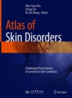 Image for Atlas of Skin Disorders: Challenging Presentations of Common to Rare Conditions