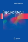 Image for Ruptured Uterus