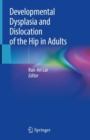 Image for Developmental dysplasia and dislocation of the hip in adults