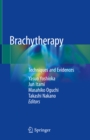 Image for Brachytherapy: Techniques and Evidences