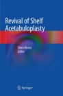 Image for Revival of Shelf Acetabuloplasty