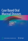 Image for Case Based Oral Mucosal Diseases