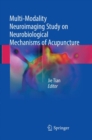 Image for Multi-Modality Neuroimaging Study on Neurobiological Mechanisms of Acupuncture