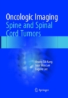 Image for Oncologic Imaging: Spine and Spinal Cord Tumors