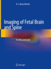 Image for Imaging of Fetal Brain and Spine : An Atlas and Guide