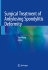 Image for Surgical Treatment of Ankylosing Spondylitis Deformity
