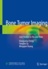 Image for Bone Tumor Imaging