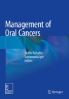 Image for Management of Oral Cancers