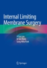 Image for Internal Limiting Membrane Surgery