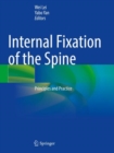 Image for Internal fixation of the spine  : principles and practice