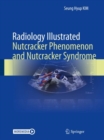 Image for Radiology Illustrated: Nutcracker Phenomenon and Nutcracker Syndrome