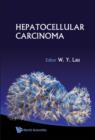 Image for Hepatocellular carcinoma