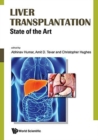 Image for Liver Transplantation: State Of The Art