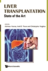 Image for Liver transplantation: state of the art