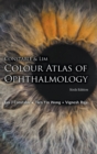 Image for Colour atlas of ophthalmology